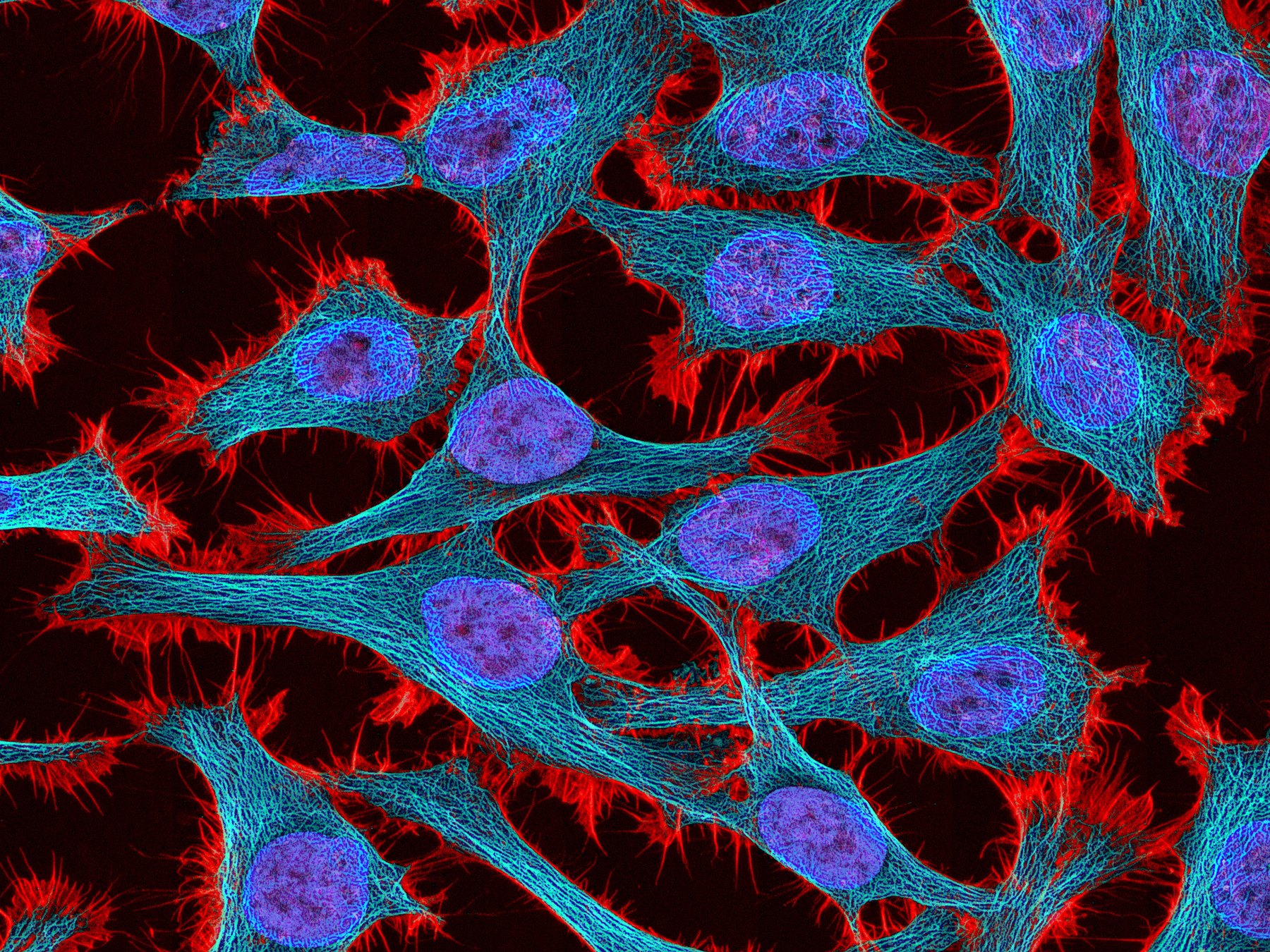Biomedical research imagery representing UDD therapeutic disease programs